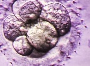 怀孕36天每晚都会外阴瘙痒并伴随白带多该怎么办？